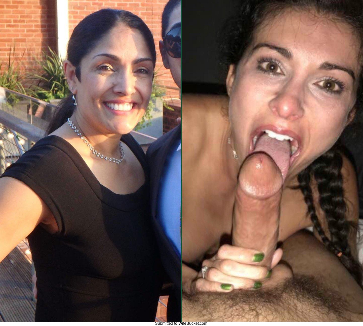 Hairy wife before after picture
